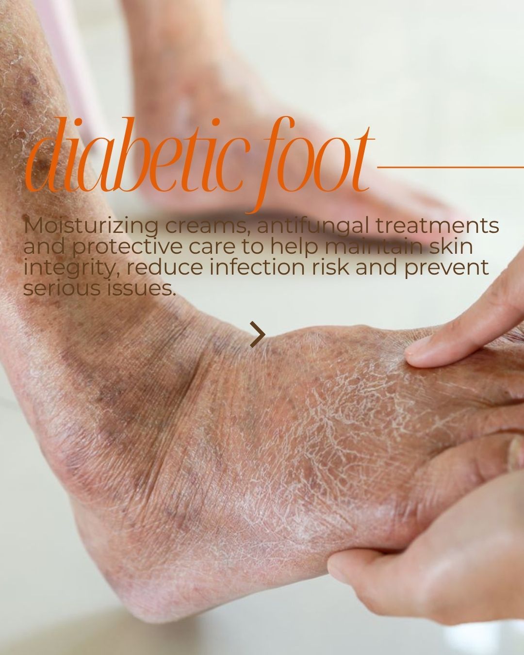 DIABETIC FOOT